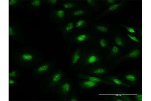 Immunofluorescence of monoclonal antibody to FBXO7 on HeLa cell.