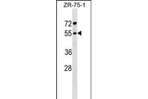 ARCN1 Antibody (Center) (ABIN1538264 and ABIN2849231) western blot analysis in ZR-75-1 cell line lysates (35 μg/lane). (ARCN1 anticorps  (AA 296-324))