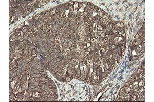 Image no. 5 for anti-PHD Finger Protein 7 (PHF7) (AA 155-381) antibody (ABIN1490975)