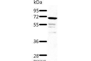 Western blot analysis of Human fetal kidney tissue, using TRAF3 Polyclonal Antibody at dilution of 1:500