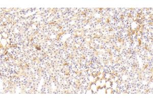 Detection of ITIH4 in Rat Kidney Tissue using Polyclonal Antibody to Inter Alpha-Globulin Inhibitor H4 (ITIH4)