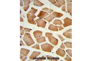 Formalin-fixed and paraffin-embedded human skeletal muscle reacted with AMPD2 Antibody (Center), which was peroxidase-conjugated to the secondary antibody, followed by DAB staining. (AMPD2 anticorps  (Middle Region))