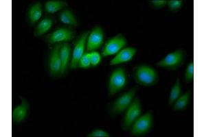Immunofluorescence staining of A549 cells with ABIN7157473 at 1:166, counter-stained with DAPI.