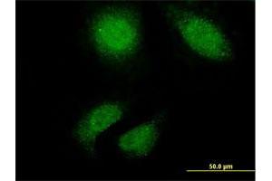 Immunofluorescence of monoclonal antibody to TTN on HeLa cell. (Titin anticorps  (AA 1-110))