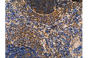 ABIN6262672 and ABIN6276585 at 1/100 staining Rat spleen tissue by IHC-P.