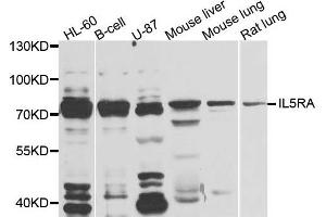 Western blot analysis of extracts of various cells, using IL5RA antibody. (IL5RA anticorps)