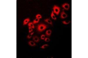 Immunofluorescent analysis of VAP-B/C staining in Hela cells.