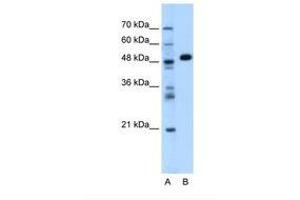 Image no. 1 for anti-Alanine Aminotransferase (ALT) (AA 115-164) antibody (ABIN320980) (ALT anticorps  (AA 115-164))