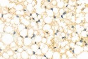 Immunohistochemistry analysis of paraffin-embedded rat brown fat using,Resistin (ABIN7075402) at dilution of 1: 800 (Resistin anticorps)