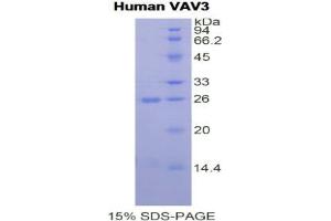 SDS-PAGE analysis of Human Vav 3 Oncogene Protein. (VAV3 Protéine)