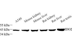 Western blot analysis of IDO2 (ABIN7074281) at dilution of 1: 500 (IDO2 anticorps)