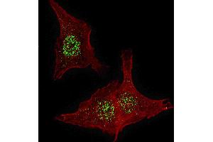 Fluorescent confocal image of HeLa cells stained with FGFR4 antibody.