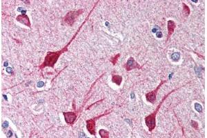Human Brain, Cortex (formalin-fixed, paraffin-embedded) stained with NLRP1 antibody ABIN214515 at 2.