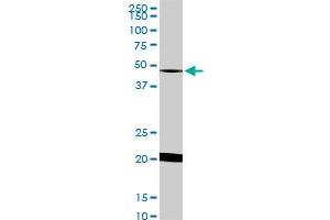 NADK monoclonal antibody (M01), clone 5F4 Western Blot analysis of NADK expression in HeLa . (NADK anticorps  (AA 1-446))