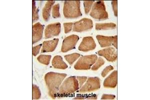 Formalin-fixed and paraffin-embedded human skeletal muscle reacted with PECI Antibody (C-term), which was peroxidase-conjugated to the secondary antibody, followed by DAB staining.