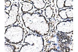 IHC analysis of RAD18 using anti-RAD18 antibody (ABIN7599364).