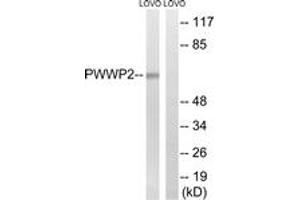 Western blot analysis of extracts from LOVO cells, using PWWP2B Antibody. (PWWP2B anticorps  (AA 268-317))