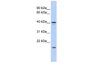 SLAIN1 antibody used at 1 ug/ml to detect target protein. (SLAIN1 anticorps  (Middle Region))