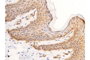 ABIN6267308 at 1/100 staining human skin tissue sections by IHC-P.