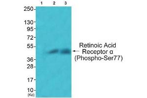 Western blot analysis of extracts from JK cells (Lane 2) and COS7 cells (Lane 3), using Retinoic Acid Receptor α (Phospho-Ser77) Antibody. (Retinoic Acid Receptor alpha anticorps  (pSer77))