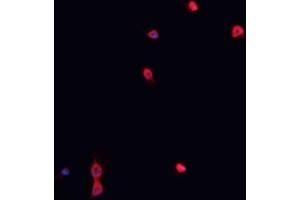 ABIN6267023 staining K-562 cells by IF/ICC.