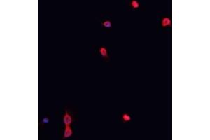 ABIN6267023 staining K-562 cells by IF/ICC. (Nibrin anticorps  (pSer278))