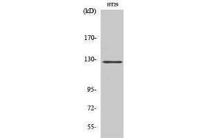 Western Blotting (WB) image for anti-PTK2 Protein tyrosine Kinase 2 (PTK2) (Thr435) antibody (ABIN3180042) (FAK anticorps  (Thr435))