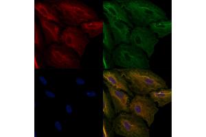 ABIN6257890 and ABIN6274946 staining  cells by IF/ICC. (CAGE1 anticorps  (C-Term))
