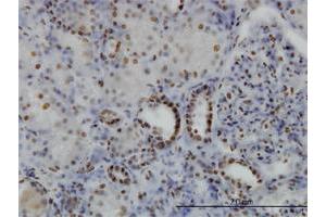 Immunoperoxidase of monoclonal antibody to SGK on formalin-fixed paraffin-embedded human kidney.
