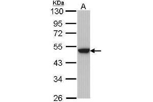 WB Image Sample (30 ug of whole cell lysate) A: Hela 10% SDS PAGE antibody diluted at 1:1000 (Keratin 31 anticorps)