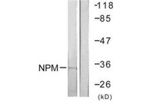 Western blot analysis of extracts from Jurkat cells, using NPM (Ab-199) Antibody. (NPM1 anticorps  (AA 171-220))