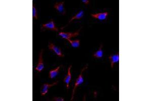 Image no. 3 for anti-KIT Ligand (KITLG) (C-Term) antibody (ABIN357009) (KIT Ligand anticorps  (C-Term))