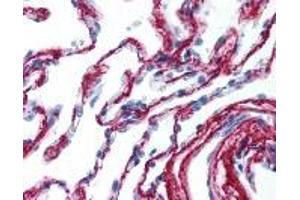 Immunohistochemistry (IHC) image for anti-Collagen, Type VI, alpha 1 (COL6A1) antibody (ABIN2470329)