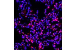 Immunofluorescence of paraffin embedded rat lung using NSFL1C (ABIN7074865) at dilution of 1:650 (400x lens)