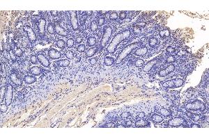 Detection of MPO in Bovine Colon Tissue using Monoclonal Antibody to Myeloperoxidase (MPO) (Myeloperoxidase anticorps)