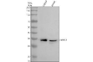 Western blot analysis of NKX3-1 using anti-NKX3-1 antibody (ABIN7825615).