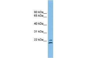 WB Suggested Anti-TSPAN1 Antibody Titration: 0. (TSPAN1 anticorps  (Middle Region))
