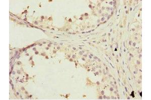 Immunohistochemistry of paraffin-embedded human testis tissue using ABIN7157257 at dilution of 1:100 (KBTBD7 anticorps  (AA 475-684))