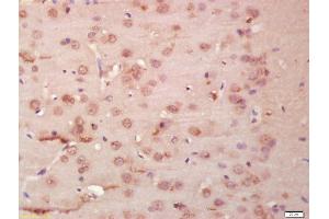 Formalin-fixed and paraffin embedded rat brain labeled with Anti-tubulin Beta Polyclonal Antibody, Unconjugated (ABIN706721) at 1:200 followed by conjugation to the secondary antibody and DAB staining