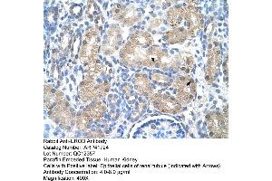 Rabbit Anti-UROD Antibody  Paraffin Embedded Tissue: Human Kidney Cellular Data: Epithelial cells of renal tubule Antibody Concentration: 4. (UROD anticorps  (N-Term))