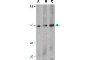 Western blot analysis of PLXDC1 in human liver tissue lysate with PLXDC1 polyclonal antibody  at (A) 0. (PLXDC1 anticorps  (C-Term))