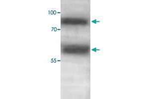 Western blot analysis of human fetal skeletal muscle lysate with ADAMTS1 polyclonal antibody  at 1 : 500 dilution. (ADAMTS1 anticorps  (C-Term))
