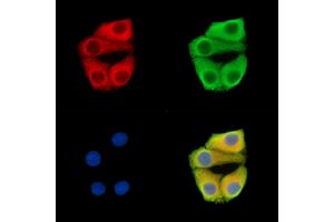 ABIN7096380 and ABIN7100444 staining Hela cells by IF/ICC. (PMPCA anticorps)