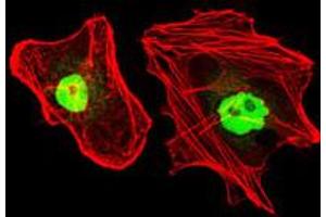 Image no. 3 for anti-Replication Protein A1, 70kDa (RPA1) antibody (ABIN1500741)