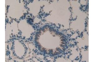 Detection of MMP9 in Rat Lung Tissue using Polyclonal Antibody to Matrix Metalloproteinase 9 (MMP9)