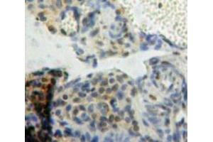 IHC-P analysis of Ovary tissue, with DAB staining. (BCL9 anticorps  (AA 1119-1328))