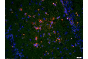 Paraformaldehyde-fixed, paraffin embedded (Mouse Brain) Antigen retrieval by boiling in sodium citrate buffer (pH6.