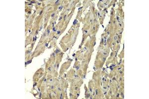 Immunohistochemistry of paraffin-embedded mouse heart using FXN antibody. (Frataxin anticorps  (AA 42-210))