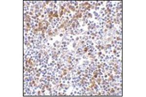 Immunohistochemistry of MDA5 in human lymph node tissue with this product at 5 μg/ml. (IFIH1 anticorps  (C-Term))