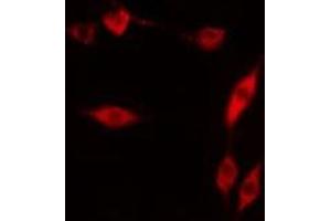 ABIN6276522 staining  COLO205 cells by IF/ICC.